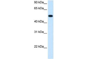Image no. 1 for anti-Betaine--Homocysteine S-Methyltransferase (BHMT) (C-Term) antibody (ABIN629748)
