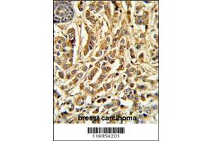 Immunohistochemistry (IHC) image for anti-Cytochrome P450, Family 21, Subfamily A, Polypeptide 2 (CYP21A2) antibody (ABIN2158436)