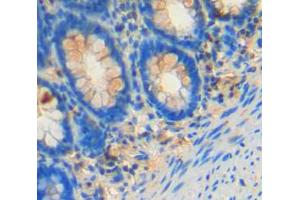 Image no. 2 for anti-Feline Sarcoma Oncogene (FES) (AA 509-766) antibody (ABIN5013542)