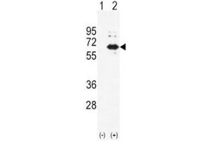 Image no. 3 for anti-Alkaline Phosphatase, Liver/bone/kidney (ALPL) (AA 217-246) antibody (ABIN3029909)