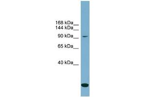 Image no. 2 for anti-Solute Carrier Family 12 (Potassium-Chloride Transporter) Member 4 (SLC12A4) (N-Term) antibody (ABIN2781617)