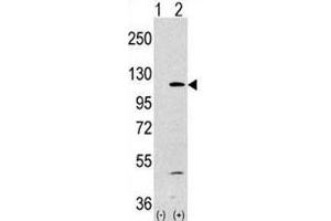 Image no. 3 for anti-Phosphoinositide-3-Kinase, Catalytic, alpha Polypeptide (PIK3CA) (AA 504-533) antibody (ABIN3028924)
