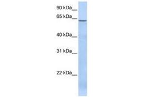 Image no. 1 for anti-TBC1 Domain Family, Member 22A (TBC1D22A) (AA 108-157) antibody (ABIN6741275)