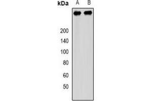 Image no. 2 for anti-Pericentriolar Material 1 (PCM1) antibody (ABIN3197758)
