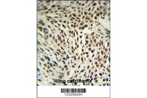 Immunohistochemistry (IHC) image for anti-Small Nuclear Ribonucleoprotein D3 Polypeptide 18kDa (SNRPD3) (C-Term) antibody (ABIN2503218)