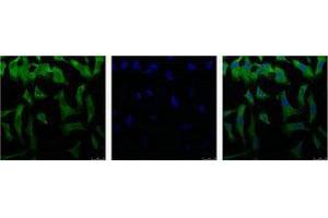Image no. 2 for anti-Eukaryotic Translation Initiation Factor 4A1 (EIF4A1) antibody (ABIN3181206)