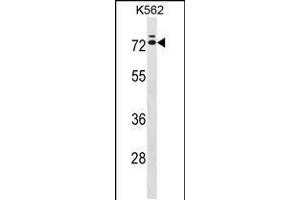 Image no. 1 for anti-Interleukin 23 (IL23) (AA 428-457), (C-Term) antibody (ABIN5533196)