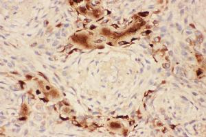 Image no. 2 for anti-Osteocalcin (BGLAP) (AA 52-100) antibody (ABIN3042320)
