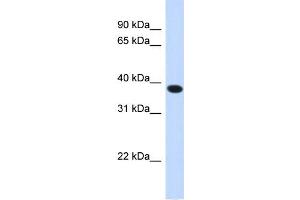 Image no. 1 for anti-Acyl-CoA Binding Domain Containing 4 (ACBD4) (N-Term) antibody (ABIN2783937)