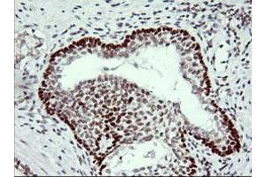 Image no. 3 for anti-Tumor Protein P73 (TP73) (AA 167-409) antibody (ABIN1491005)