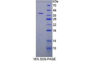 Image no. 1 for 5'-Nucleotidase, Cytosolic III (NT5C3) protein (ABIN3008030)