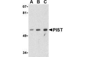 Image no. 3 for anti-Golgi-Associated PDZ and Coiled-Coil Motif Containing (GOPC) (Middle Region) antibody (ABIN497985)