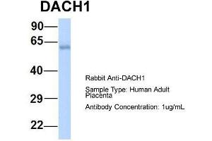 DACH1 antibody  (N-Term)