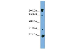 Image no. 1 for anti-Kelch-Like 2, Mayven (KLHL2) (Middle Region) antibody (ABIN2784875)