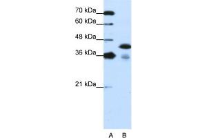 Image no. 1 for anti-TAR DNA Binding Protein (TARDBP) (C-Term) antibody (ABIN2780849)