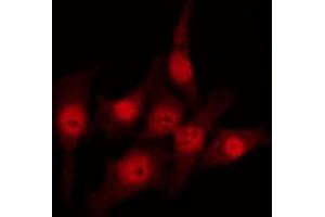 Image no. 2 for anti-MutS Homolog 3 (MSH3) (N-Term) antibody (ABIN6259073)