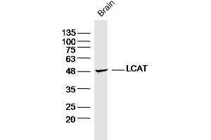 Image no. 2 for anti-Lecithin-Cholesterol Acyltransferase (LCAT) (AA 151-250) antibody (ABIN676118)