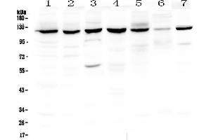 Image no. 3 for anti-Poly (ADP-Ribose) Polymerase 1 (PARP1) (AA 670-858) antibody (ABIN3043378)