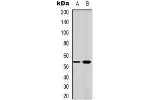 Image no. 3 for anti-serum/glucocorticoid Regulated Kinase 1 (SGK1) (C-Term) antibody (ABIN2957755)