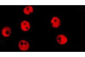 Image no. 2 for anti-T-Cell Acute Lymphocytic Leukemia 1 (TAL1) antibody (ABIN6265446)