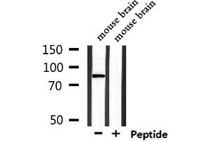 Image no. 2 for anti-Transmembrane Channel-Like 7 (TMC7) (C-Term) antibody (ABIN6265609)