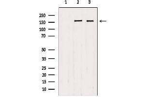 Image no. 3 for anti-Protein Tyrosine Phosphatase F Interacting Protein 1 (PPFIA1) (C-Term) antibody (ABIN6262980)