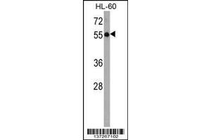 Image no. 1 for anti-Kelch-Like 3 (KLHL3) (AA 207-234) antibody (ABIN1538073)