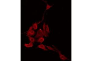 Image no. 2 for anti-Leucine Zipper, Down-Regulated in Cancer 1-Like (LDOC1L) antibody (ABIN6259053)
