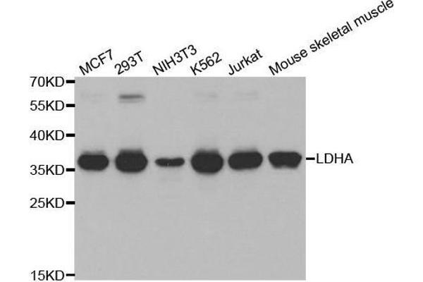 Lactate Dehydrogenase A anticorps  (AA 1-332)