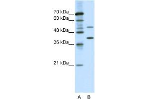 anti-REX4, RNA Exonuclease 4 Homolog (REXO4) (C-Term) antibody
