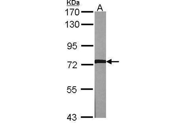 anti-Adrenergic, Beta, Receptor Kinase 1 (ADRBK1) (C-Term) antibody