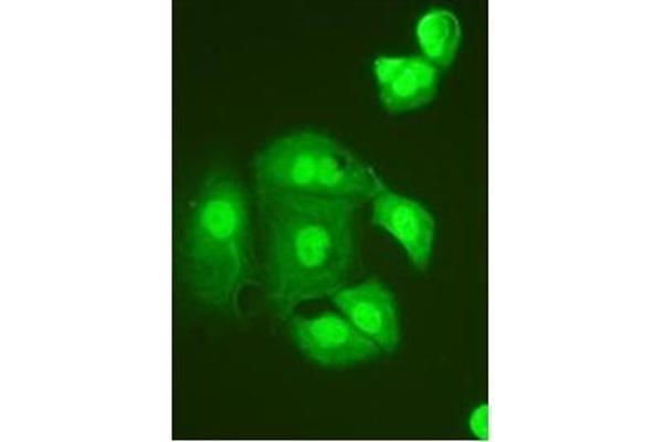 anti-Tumor Necrosis Factor, alpha-Induced Protein 1 (Endothelial) (TNFAIP1) (N-Term) antibody