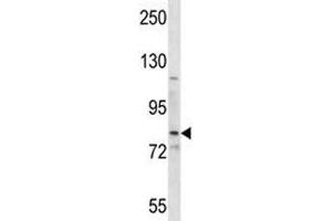 Image no. 1 for anti-Smoothened Homolog (Drosophila) (SMO) (AA 539-567) antibody (ABIN3029016)
