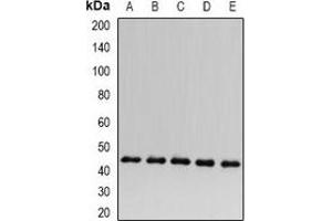 Image no. 3 for anti-Acyl-CoA Dehydrogenase, C-2 To C-3 Short Chain (Acads) antibody (ABIN2966376)