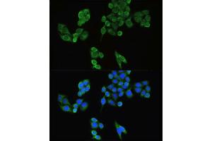 Image no. 6 for anti-Interferon Regulatory Factor 3 (IRF3) antibody (ABIN1513098)