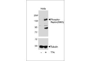 RAPTOR antibody  (pSer863)