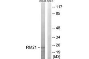 Image no. 1 for anti-Mitochondrial Ribosomal Protein L21 (MRPL21) (AA 131-180) antibody (ABIN1534524)