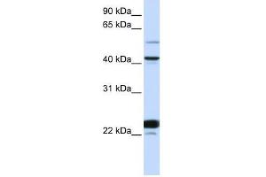 Image no. 1 for anti-EVX1 (EVX1) (N-Term) antibody (ABIN929023)
