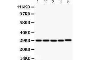 Image no. 3 for anti-CD40 Ligand (CD40LG) (AA 47-65), (N-Term) antibody (ABIN3044319)