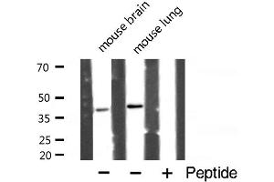 Image no. 2 for anti-Polymerase (DNA Directed), beta (POLB) (C-Term) antibody (ABIN6264332)
