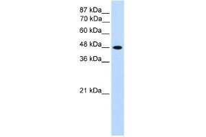 Image no. 2 for anti-Transcription Factor AP-2 gamma (Activating Enhancer Binding Protein 2 Gamma) (TFAP2C) (N-Term) antibody (ABIN2780497)