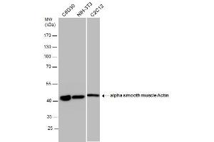 Image no. 4 for anti-Actin, alpha 2, Smooth Muscle, Aorta (ACTA2) (N-Term) antibody (ABIN2857027)