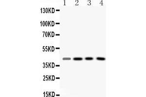 Image no. 3 for anti-Vasodilator-Stimulated phosphoprotein (VASP) (AA 78-114), (N-Term) antibody (ABIN4886759)