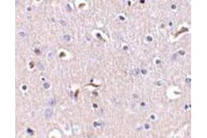 Image no. 1 for anti-Anterior Pharynx Defective 1 Homolog A (C. Elegans) (APH1A) (Middle Region) antibody (ABIN499309)