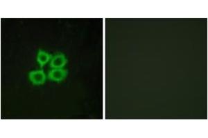 Image no. 2 for anti-Corticotropin Releasing Hormone Receptor 2 (CRHR2) (AA 71-120) antibody (ABIN1535581)