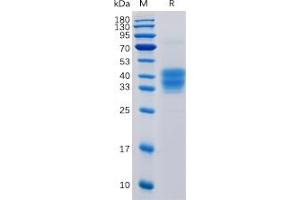 Image no. 1 for CD52 (CD52) protein (mFc Tag) (ABIN6964072)