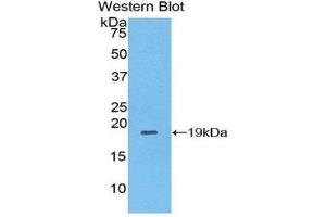 COL8A1 antibody  (AA 590-744)