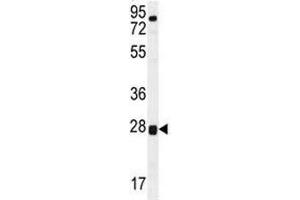 Image no. 2 for anti-Torsin Family 2, Member A (TOR2A) (AA 194-221) antibody (ABIN3029188)
