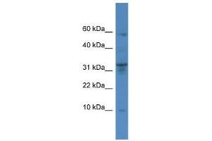 Image no. 1 for anti-Cathepsin C (CTSC) (Middle Region) antibody (ABIN929442)