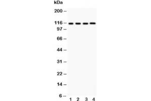 Image no. 1 for anti-NLR Family, Pyrin Domain Containing 3 (NLRP3) (AA 21-194) antibody (ABIN3032019)